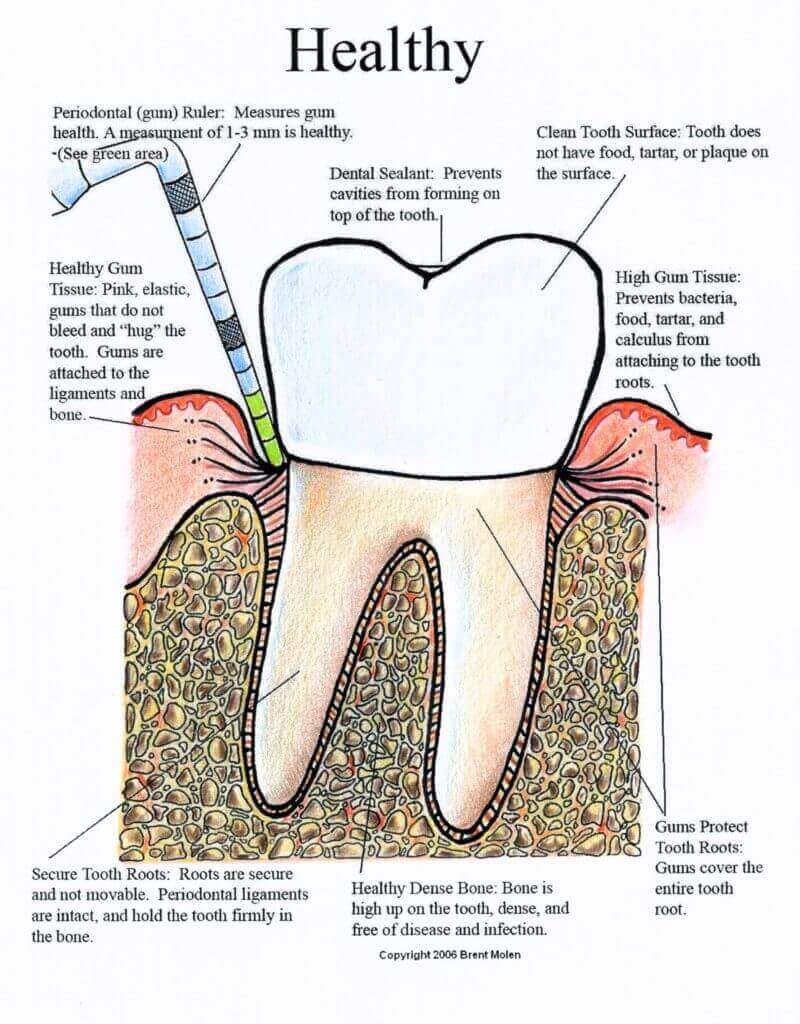 periodontal treatment