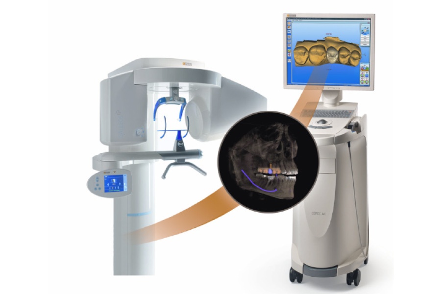 Image of a CEREC same-day crown machine with digital technology and in-house milling.