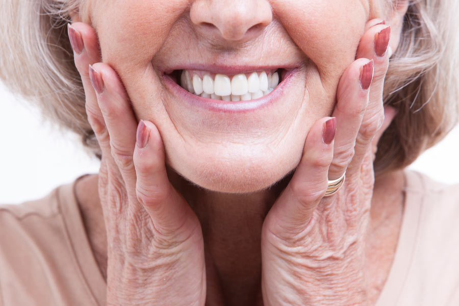 Close up smile of a woman with dental veneers.
